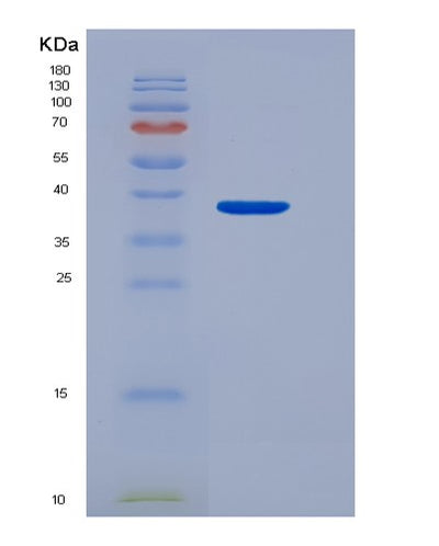 SDS-PAGE analysis of Mouse Cd274 (Programmed Cell Death 1 Ligand 1) - Recombinant Protein, CAT# BLT-00483P, showing >85% purity under 15% SDS-PAGE (Reduced)Mouse Cd274 (Programmed Cell Death 1 Ligand 1) - Recombinant Protein
