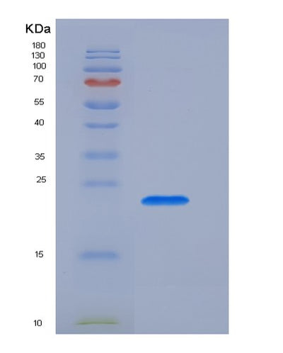 SDS-PAGE analysis of Human CD3E (T-Cell Surface Glycoprotein Cd3 Epsilon Chain) - Recombinant Protein, CAT# BLT-00493P, showing >95% purity under 15% SDS-PAGE (Reduced)Human CD3E (T-Cell Surface Glycoprotein Cd3 Epsilon Chain) - Recombinant Protein