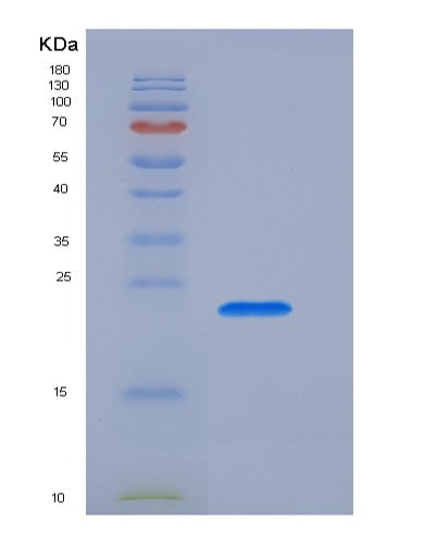 SDS-PAGE analysis of Human CD3E (T-Cell Surface Glycoprotein Cd3 Epsilon Chain) - Recombinant Protein, CATHuman CD3E (T-Cell Surface Glycoprotein Cd3 Epsilon Chain) - Recombinant Protein