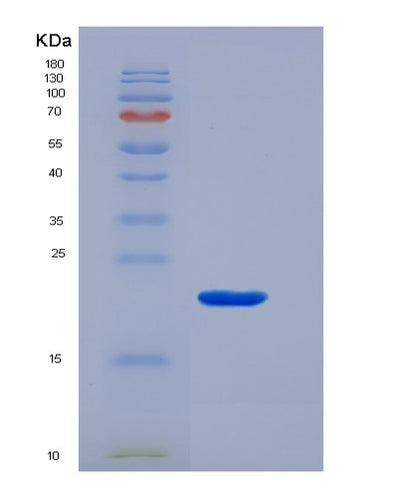 SDS-PAGE analysis of Human CD3G (T-Cell Surface Glycoprotein Cd3 Gamma Chain) - Recombinant Protein, CAT# BLT-00494P, showing >90% purity under 15% SDS-PAGE (Reduced)Human CD3G (T-Cell Surface Glycoprotein Cd3 Gamma Chain) - Recombinant Protein