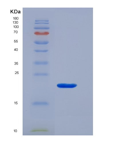 SDS-PAGE analysis of Human CD3G (T-Cell Surface Glycoprotein Cd3 Gamma Chain) - Recombinant Protein, CATHuman CD3G (T-Cell Surface Glycoprotein Cd3 Gamma Chain) - Recombinant Protein