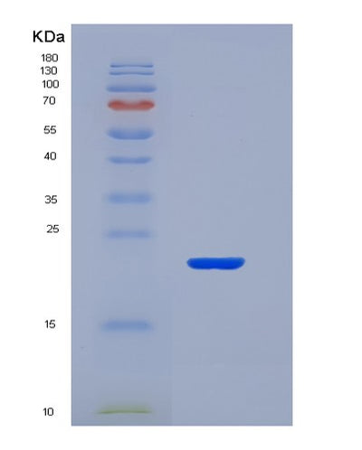 SDS-PAGE analysis of Human CD40 (Tumor Necrosis Factor Receptor Superfamily Member 5) - Recombinant Protein, CAT# BLT-00499P, showing >95% purity under 15% SDS-PAGE (Reduced)Human CD40 (Tumor Necrosis Factor Receptor Superfamily Member 5) - Recombinant Protein