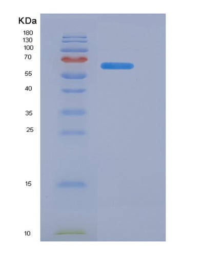 SDS-PAGE analysis of Human CD40LG (Cd40 Ligand) - Recombinant Protein, CAT# BLT-00500P, showing >90% purity under 15% SDS-PAGE (Reduced)Human CD40LG (Cd40 Ligand) - Recombinant Protein