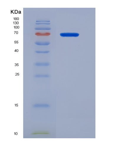 SDS-PAGE analysis of Human CD68 (Macrosialin) - Recombinant Protein, CAT# BLT-00510P, showing >95% purity under 15% SDS-PAGE (Reduced)Human CD68 (Macrosialin) - Recombinant Protein