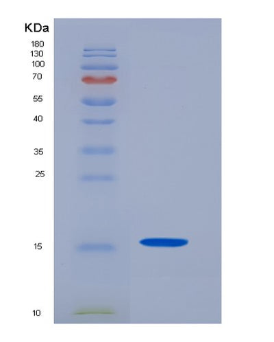 SDS-PAGE analysis of Human CD7 (T-Cell Antigen Cd7) - Recombinant Protein, CAT# BLT-00512P, showing >95% purity under 15% SDS-PAGE (Reduced)Human CD7 (T-Cell Antigen Cd7) - Recombinant Protein