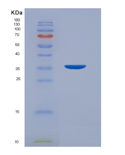 SDS-PAGE analysis of Human CD7 (T-Cell Antigen Cd7) - Recombinant Protein, CATHuman CD7 (T-Cell Antigen Cd7) - Recombinant Protein