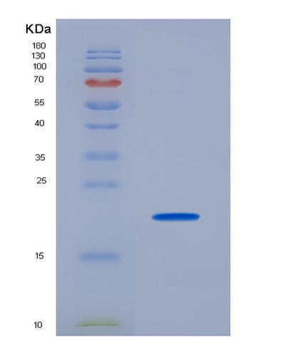 SDS-PAGE analysis of Human CD74 (Hla Class Ii Histocompatibility Antigen Gamma Chain) - Recombinant Protein, CAT# BLT-00516P, showing >95% purity under 15% SDS-PAGE (Reduced)Human CD74 (Hla Class Ii Histocompatibility Antigen Gamma Chain) - Recombinant Protein