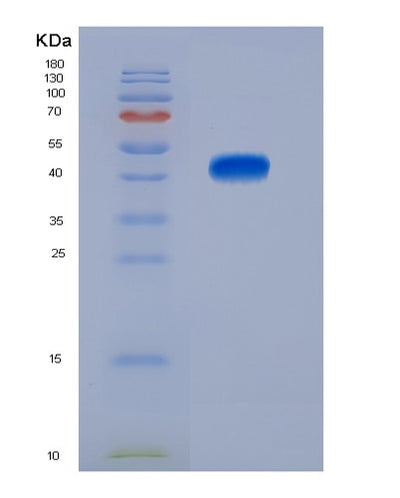SDS-PAGE analysis of Human CD74 (Hla Class Ii Histocompatibility Antigen Gamma Chain) - Recombinant Protein, CAT# BLT-00517P, showing >95% purity under 15% SDS-PAGE (Reduced)Human CD74 (Hla Class Ii Histocompatibility Antigen Gamma Chain) - Recombinant Protein