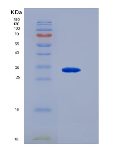 SDS-PAGE analysis of Human CD79B (B-Cell Antigen Receptor Complex-Associated Protein Beta Chain) - Recombinant Protein, CAT# BLT-00519P, showing >90% purity under 15% SDS-PAGE (Reduced)Human CD79B (B-Cell Antigen Receptor Complex-Associated Protein Beta Chain) - Recombinant Protein