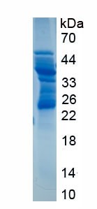 SDS-PAGE analysis of Human CD83 (Cd83 Antigen) - Recombinant Protein, CAT# BLT-00521P, showing >95% purity under 15% SDS-PAGE (Reduced)Human CD83 (Cd83 Antigen) - Recombinant Protein