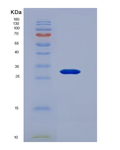SDS-PAGE analysis of Human CNTF (Ciliary Neurotrophic Factor) - Recombinant Protein, CAT# BLT-00651P, showing >95% purity under 15% SDS-PAGE (Reduced)Human CNTF (Ciliary Neurotrophic Factor) - Recombinant Protein