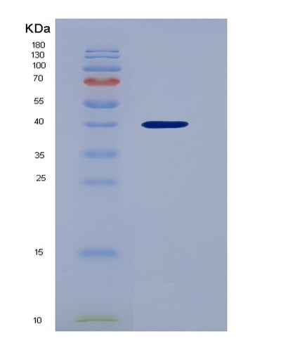 SDS-PAGE analysis of Human CXCL1 (Growth-Regulated Alpha Protein) - Recombinant Protein, CAT# BLT-00771P, showing >95% purity under 15% SDS-PAGE (Reduced)Human CXCL1 (Growth-Regulated Alpha Protein) - Recombinant Protein