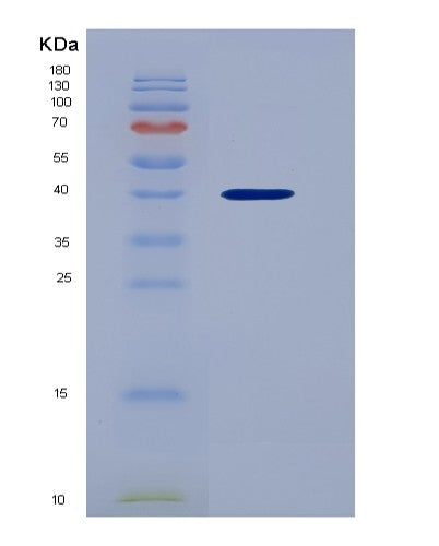 SDS-PAGE analysis of Human CXCL1 (Growth-Regulated Alpha Protein) - Recombinant Protein, CATHuman CXCL1 (Growth-Regulated Alpha Protein) - Recombinant Protein