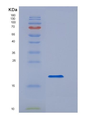 SDS-PAGE analysis of Human VWF (Von Willebrand Factor) - Recombinant Protein, CATHuman VWF (Von Willebrand Factor) - Recombinant Protein