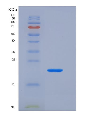 SDS-PAGE analysis of Mouse Vwf (Von Willebrand Factor) - Recombinant Protein, CAT# BLT-07187P, showing >90% purity under 15% SDS-PAGE (Reduced)Mouse Vwf (Von Willebrand Factor) - Recombinant Protein