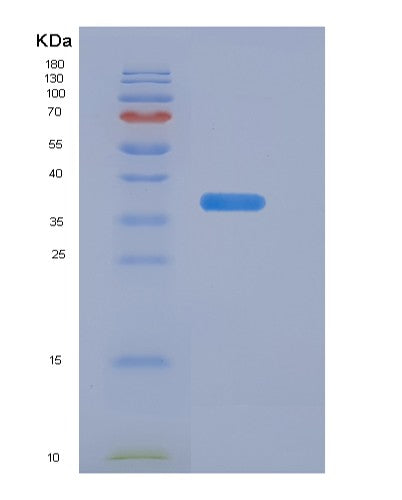 SDS-PAGE analysis of Human EGFR (Epidermal Growth Factor Receptor) - Recombinant Protein, CATHuman EGFR (Epidermal Growth Factor Receptor) - Recombinant Protein