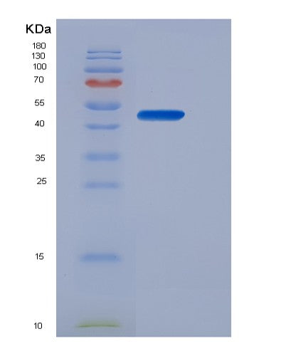 SDS-PAGE analysis of Human EPO (Erythropoietin) - Recombinant Protein, CATHuman EPO (Erythropoietin) - Recombinant Protein