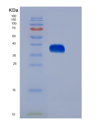 SDS-PAGE analysis of Human EPO (Erythropoietin) - Recombinant Protein, CATHuman EPO (Erythropoietin) - Recombinant Protein