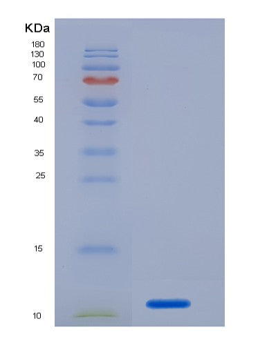 SDS-PAGE analysis of Human PECAM1 (Platelet Endothelial Cell Adhesion Molecule) - Recombinant Protein, CATHuman PECAM1 (Platelet Endothelial Cell Adhesion Molecule) - Recombinant Protein