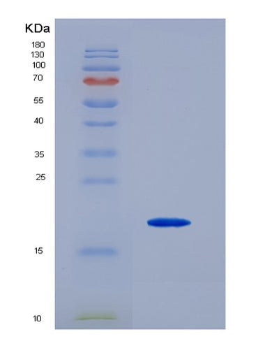 SDS-PAGE analysis of Mouse Pecam1 (Platelet Endothelial Cell Adhesion Molecule) - Recombinant Protein, CAT# BLT-07191P, showing >95% purity under 15% SDS-PAGE (Reduced)Mouse Pecam1 (Platelet Endothelial Cell Adhesion Molecule) - Recombinant Protein