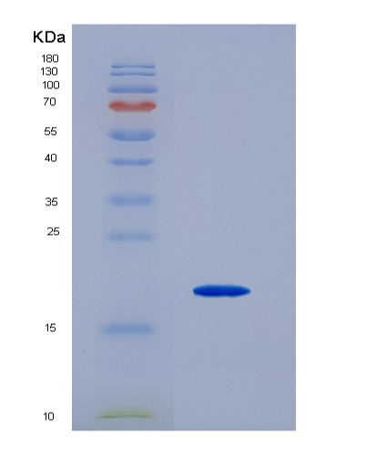 SDS-PAGE analysis of Mouse Pecam1 (Platelet Endothelial Cell Adhesion Molecule) - Recombinant Protein, CATMouse Pecam1 (Platelet Endothelial Cell Adhesion Molecule) - Recombinant Protein