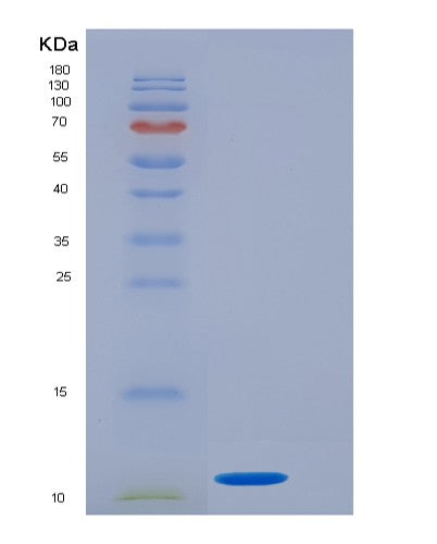 SDS-PAGE analysis of Human GTF2H5 (General Transcription Factor Iih Subunit 5) - Recombinant Protein, CATHuman GTF2H5 (General Transcription Factor Iih Subunit 5) - Recombinant Protein