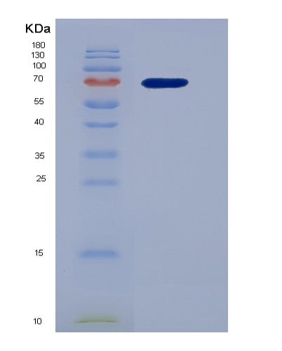 SDS-PAGE analysis of Human HGF (Hepatocyte Growth Factor) - Recombinant Protein, CATHuman HGF (Hepatocyte Growth Factor) - Recombinant Protein