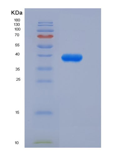 SDS-PAGE analysis of Human IGF1 (Insulin-Like Growth Factor 1) - Recombinant Protein, CAT# BLT-01489P, showing >90% purity under 15% SDS-PAGE (Reduced)Human IGF1 (Insulin-Like Growth Factor 1) - Recombinant Protein