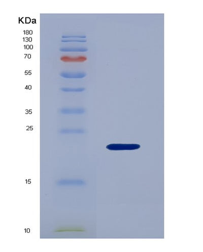 SDS-PAGE analysis of Human IGFBP3 (Insulin-Like Growth Factor-Binding Protein 3) - Recombinant Protein, CAT# BLT-01491P, showing >95% purity under 15% SDS-PAGE (Reduced)Human IGFBP3 (Insulin-Like Growth Factor-Binding Protein 3) - Recombinant Protein