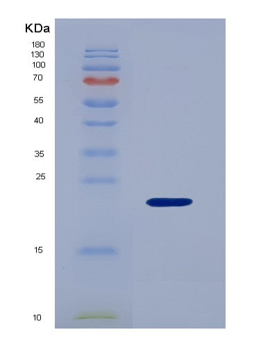 SDS-PAGE analysis of Human IGFBP3 (Insulin-Like Growth Factor-Binding Protein 3) - Recombinant Protein, CATHuman IGFBP3 (Insulin-Like Growth Factor-Binding Protein 3) - Recombinant Protein