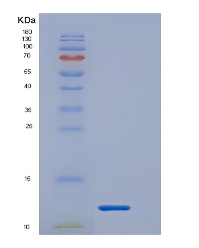 SDS-PAGE analysis of Human IL1RN (Interleukin-1 Receptor Antagonist Protein) - Recombinant Protein, CAT# BLT-01498P, showing >95% purity under 15% SDS-PAGE (Reduced)Human IL1RN (Interleukin-1 Receptor Antagonist Protein) - Recombinant Protein