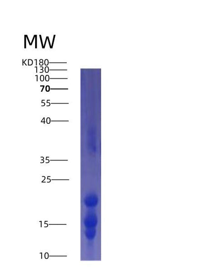 SDS-PAGE analysis of Human IL15 (Interleukin-15) - Recombinant Protein, CAT# BLT-01499P, showing >95% purity under 15% SDS-PAGE (Reduced)Human IL15 (Interleukin-15) - Recombinant Protein