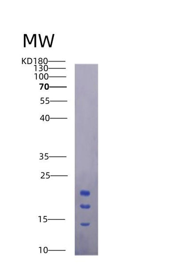 SDS-PAGE analysis of Mouse Il15 (Interleukin-15) - Recombinant Protein, CAT# BLT-01500P, showing >95% purity under 15% SDS-PAGE (Reduced)Mouse Il15 (Interleukin-15) - Recombinant Protein