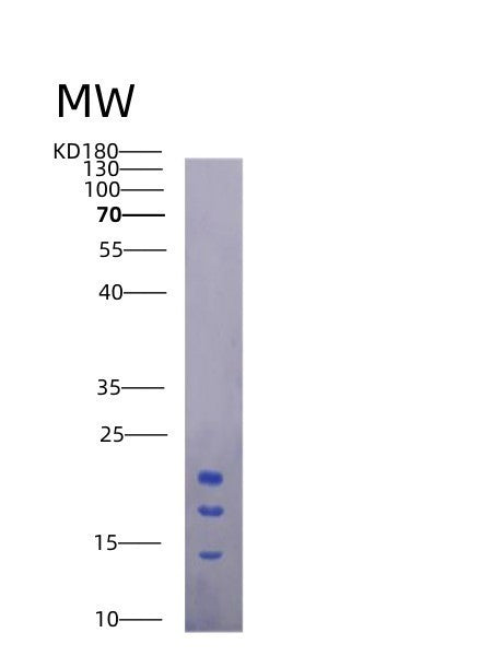 SDS-PAGE analysis of Mouse Il15 (Interleukin-15) - Recombinant Protein, CATMouse Il15 (Interleukin-15) - Recombinant Protein
