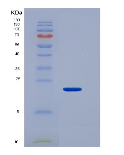 SDS-PAGE analysis of Human MUC4 (Mucin-4) - Recombinant Protein, CATHuman MUC4 (Mucin-4) - Recombinant Protein