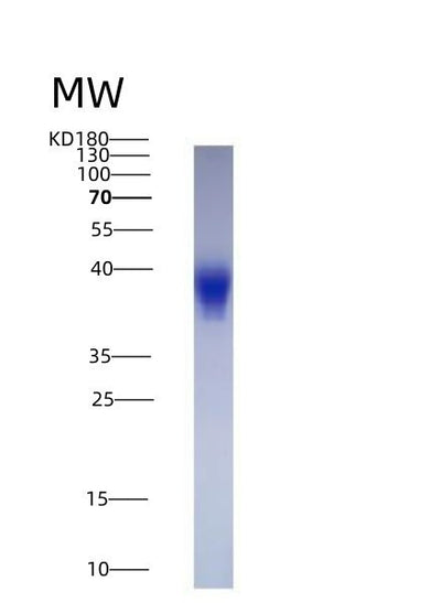 SDS-PAGE analysis of Human LIF (Leukemia Inhibitory Factor) - Recombinant Protein, CAT# BLT-01718P, showing >90% purity under 15% SDS-PAGE (Reduced)Human LIF (Leukemia Inhibitory Factor) - Recombinant Protein