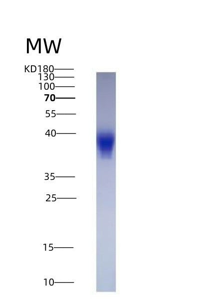 SDS-PAGE analysis of Human LIF (Leukemia Inhibitory Factor) - Recombinant Protein, CATHuman LIF (Leukemia Inhibitory Factor) - Recombinant Protein