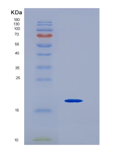 SDS-PAGE analysis of Human NUTF2 (Nuclear Transport Factor 2) - Recombinant Protein, CATHuman NUTF2 (Nuclear Transport Factor 2) - Recombinant Protein