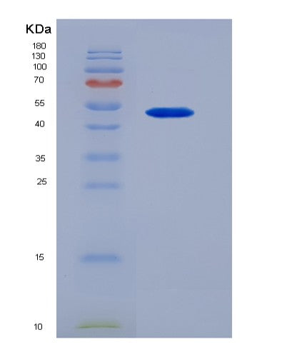 SDS-PAGE analysis of Human OSM (Oncostatin-M) - Recombinant Protein, CATHuman OSM (Oncostatin-M) - Recombinant Protein