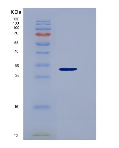 SDS-PAGE analysis of Human PDGFB (Platelet-Derived Growth Factor Subunit B) - Recombinant Protein, CATHuman PDGFB (Platelet-Derived Growth Factor Subunit B) - Recombinant Protein