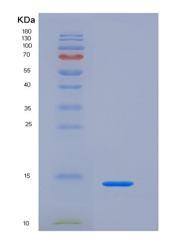 SDS-PAGE analysis of Human TFF1 (Trefoil Factor 1) - Recombinant Protein, CATHuman TFF1 (Trefoil Factor 1) - Recombinant Protein