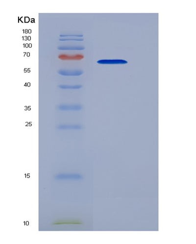 SDS-PAGE analysis of Human TNFRSF10C (Tumor Necrosis Factor Receptor Superfamily Member 10C) - Recombinant Protein, CAT# BLT-03066P, showing >90% purity under 15% SDS-PAGE (Reduced)Human TNFRSF10C (Tumor Necrosis Factor Receptor Superfamily Member 10C) - Recombinant Protein