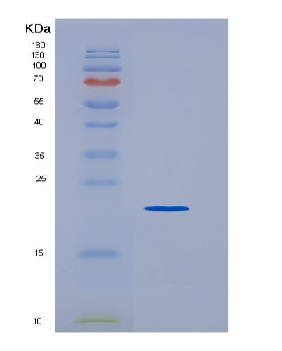 SDS-PAGE analysis of Human TNFRSF8 (Tumor Necrosis Factor Receptor Superfamily Member 8) - Recombinant Protein, CATHuman TNFRSF8 (Tumor Necrosis Factor Receptor Superfamily Member 8) - Recombinant Protein