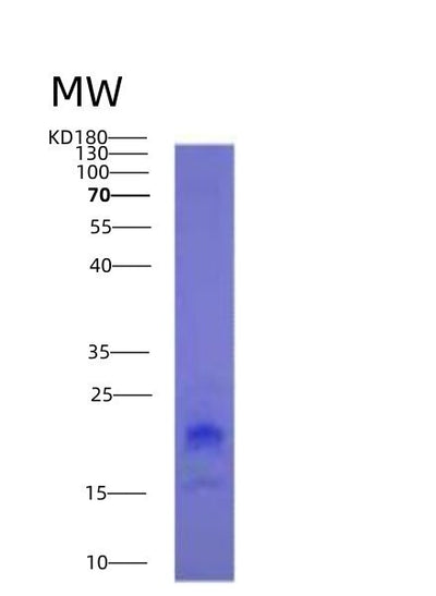SDS-PAGE analysis of Human TNFSF18 (Tumor Necrosis Factor Ligand Superfamily Member 18) - Recombinant Protein, CAT# BLT-03087P, showing >95% purity under 15% SDS-PAGE (Reduced)Human TNFSF18 (Tumor Necrosis Factor Ligand Superfamily Member 18) - Recombinant Protein