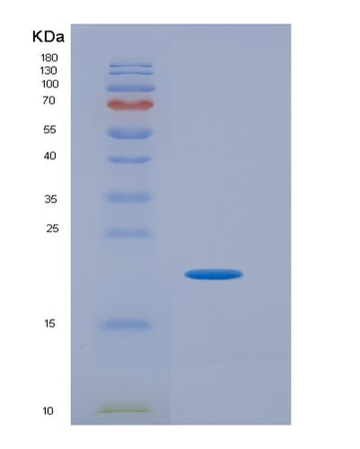 SDS-PAGE analysis of Human VEGFC (Vascular Endothelial Growth Factor C) - Recombinant Protein, CAT# BLT-03288P, showing >90% purity under 15% SDS-PAGE (Reduced)Human VEGFC (Vascular Endothelial Growth Factor C) - Recombinant Protein