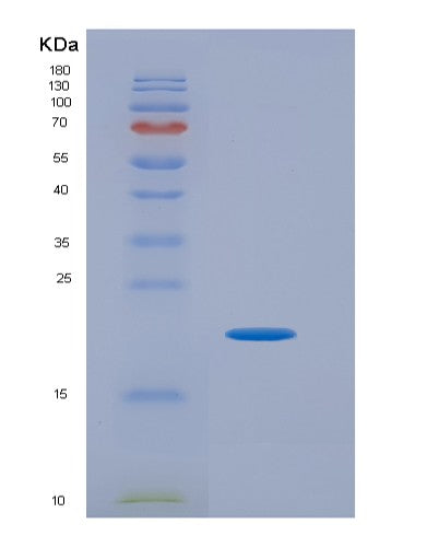 SDS-PAGE analysis of Human VEGFC (Vascular Endothelial Growth Factor C) - Recombinant Protein, CATHuman VEGFC (Vascular Endothelial Growth Factor C) - Recombinant Protein