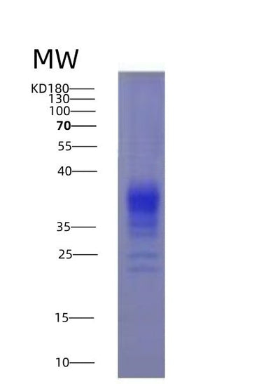 SDS-PAGE analysis of Human IFNG (Interferon Gamma) - Recombinant Protein, CAT# BLT-03474P, showing >95% purity under 15% SDS-PAGE (Reduced)Human IFNG (Interferon Gamma) - Recombinant Protein