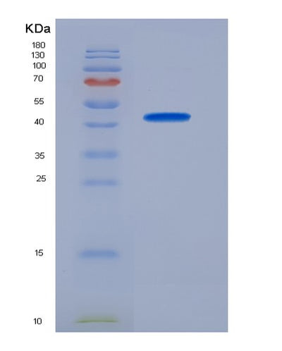 SDS-PAGE analysis of Mouse Slc5a2 (Sodium/Glucose Cotransporter 2) - Recombinant Protein, CAT# BLT-08441P showing >95% purity under 15% SDS-PAGE (Reduced)Mouse Slc5a2 (Sodium/Glucose Cotransporter 2) - Recombinant Protein