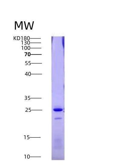 SDS-PAGE analysis of Human FAS (Tumor Necrosis Factor Receptor Superfamily Member 6) - Recombinant Protein, CAT# BLT-03980P, showing >90% purity under 15% SDS-PAGE (Reduced)Human FAS (Tumor Necrosis Factor Receptor Superfamily Member 6) - Recombinant Protein