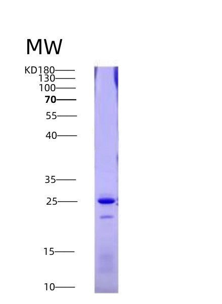 SDS-PAGE analysis of Human FAS (Tumor Necrosis Factor Receptor Superfamily Member 6) - Recombinant Protein, CATHuman FAS (Tumor Necrosis Factor Receptor Superfamily Member 6) - Recombinant Protein